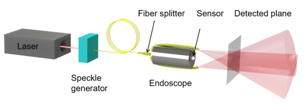 Honor lansirao prvi dodatak za kameru sa “speckle structured light” tehnologijom.Rivalstvo ( (6)